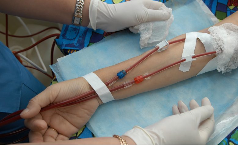In Centre Dialysis Prevent Cross Infecions
